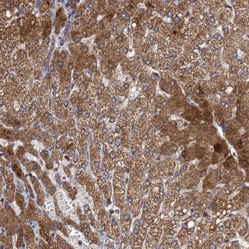Serine Dehydratase Antibody Immunohistochemistry-Paraffin: Serine Dehydratase Antibody [NBP1-87070] -