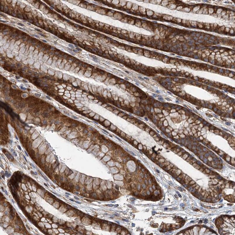 Serine Dehydratase Antibody Immunohistochemistry-Paraffin: Serine Dehydratase Antibody [NBP1-87070] -