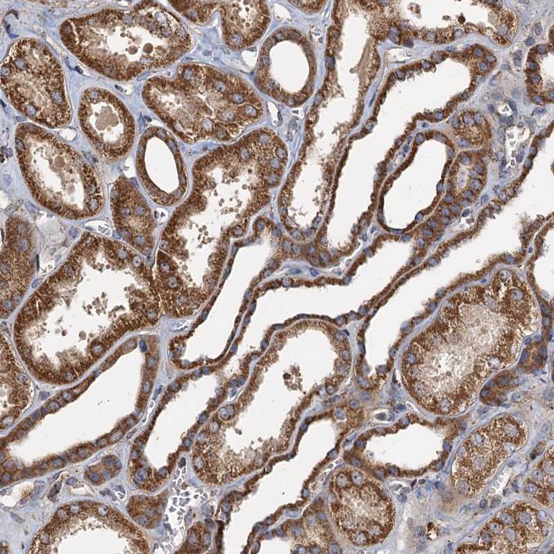 Serine Dehydratase Antibody Immunohistochemistry-Paraffin: Serine Dehydratase Antibody [NBP1-87070] -