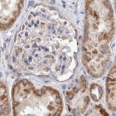 SCO1 Antibody - BSA Free Immunohistochemistry-Paraffin: SCO1 Antibody [NBP1-87074]