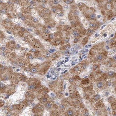 SCO1 Antibody - BSA Free Immunohistochemistry-Paraffin: SCO1 Antibody [NBP1-87074]