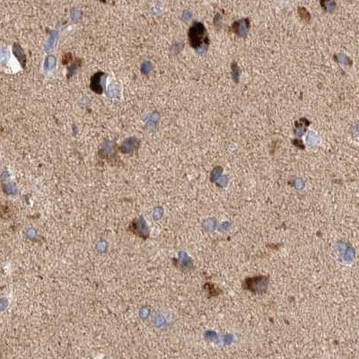 SCO1 Antibody - BSA Free Immunohistochemistry-Paraffin: SCO1 Antibody [NBP1-87074]