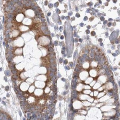 SCO1 Antibody - BSA Free Immunohistochemistry-Paraffin: SCO1 Antibody [NBP1-87074]