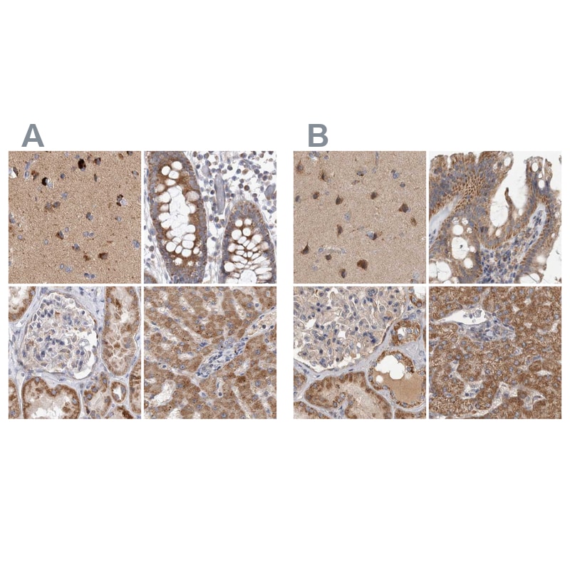 SCO1 Antibody - BSA Free Immunohistochemistry-Paraffin: SCO1 Antibody [NBP1-87074]