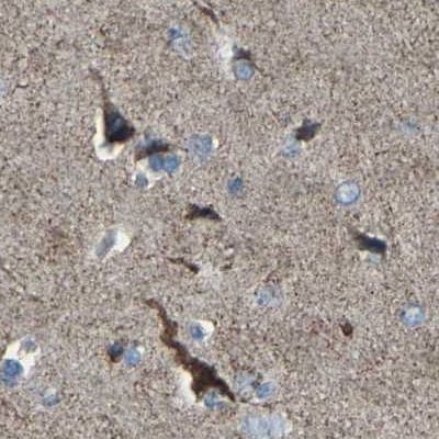Calcium Activated Nucleotidase 1/CANT1 Antibody - BSA Free Immunohistochemistry: Calcium Activated Nucleotidase 1/CANT1 Antibody - BSA Free [NBP1-87082]