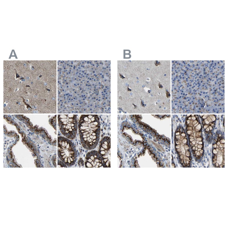 Calcium Activated Nucleotidase 1/CANT1 Antibody - BSA Free Immunohistochemistry: Calcium Activated Nucleotidase 1/CANT1 Antibody - BSA Free [NBP1-87082]