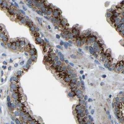 Calcium Activated Nucleotidase 1/CANT1 Antibody - BSA Free Immunohistochemistry: Calcium Activated Nucleotidase 1/CANT1 Antibody - BSA Free [NBP1-87082]