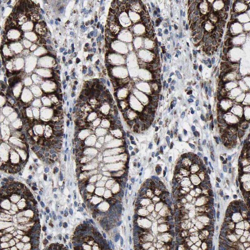 Calcium Activated Nucleotidase 1/CANT1 Antibody - BSA Free Immunohistochemistry: Calcium Activated Nucleotidase 1/CANT1 Antibody - BSA Free [NBP1-87082]