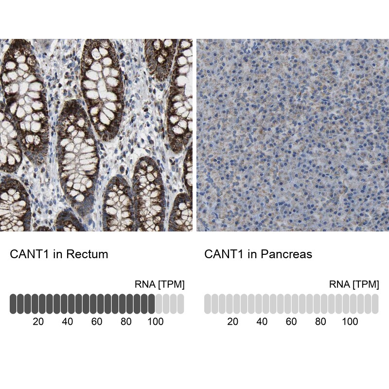 Calcium Activated Nucleotidase 1/CANT1 Antibody - BSA Free Immunohistochemistry: Calcium Activated Nucleotidase 1/CANT1 Antibody - BSA Free [NBP1-87082]