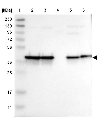 NANS Antibody - BSA Free Western Blot: NANS Antibody - BSA Free [NBP1-87088]