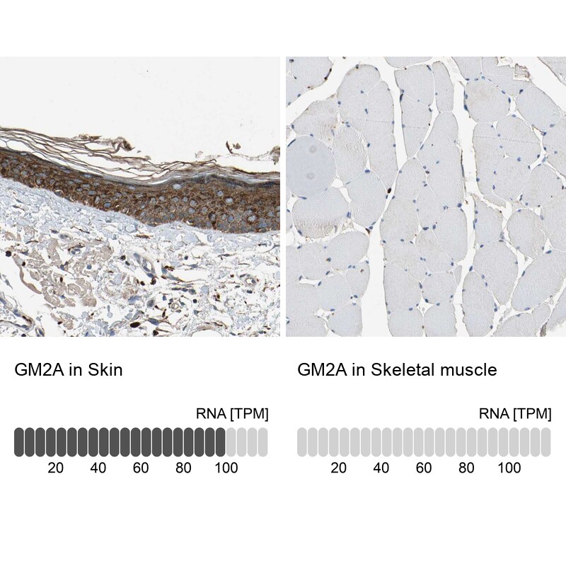 GM2A Antibody - BSA Free Immunohistochemistry-Paraffin: GM2A Antibody - BSA Free [NBP1-87090]