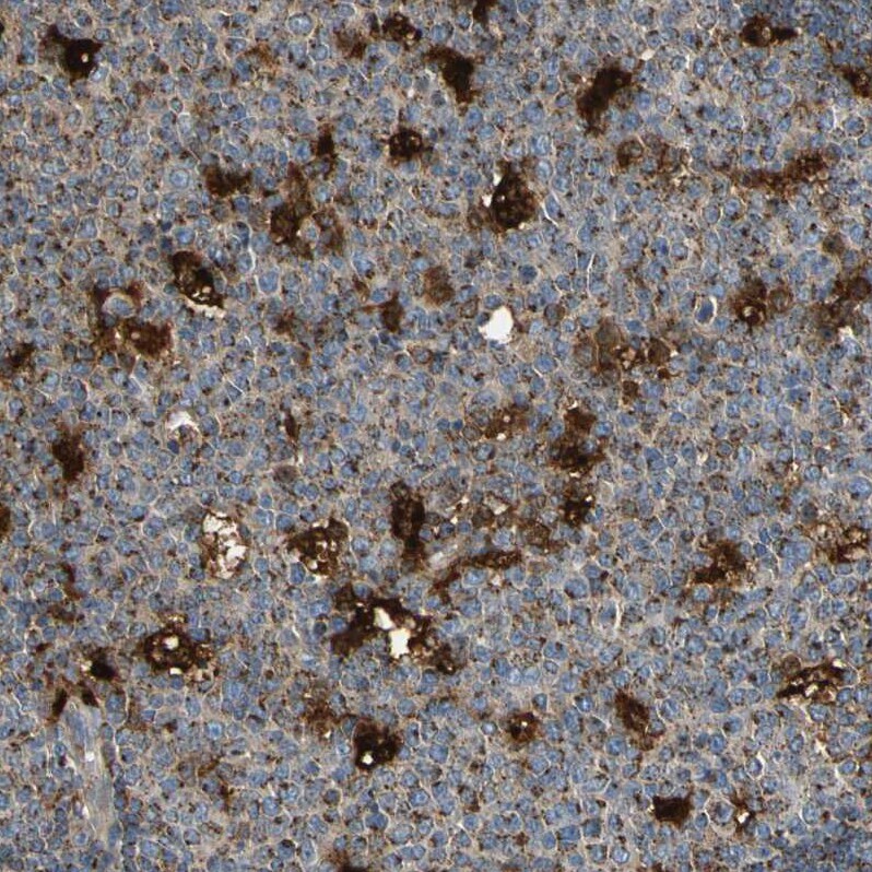 GM2A Antibody - BSA Free Immunohistochemistry-Paraffin: GM2A Antibody - BSA Free [NBP1-87090]