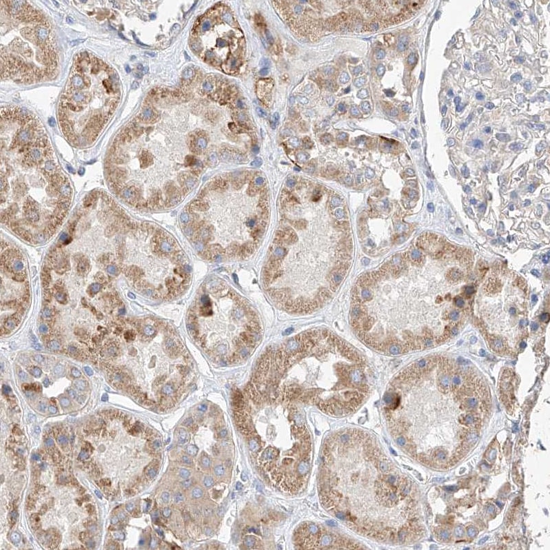 AMD1 Antibody - BSA Free Immunohistochemistry: AMD1 Antibody - BSA Free [NBP1-87093]