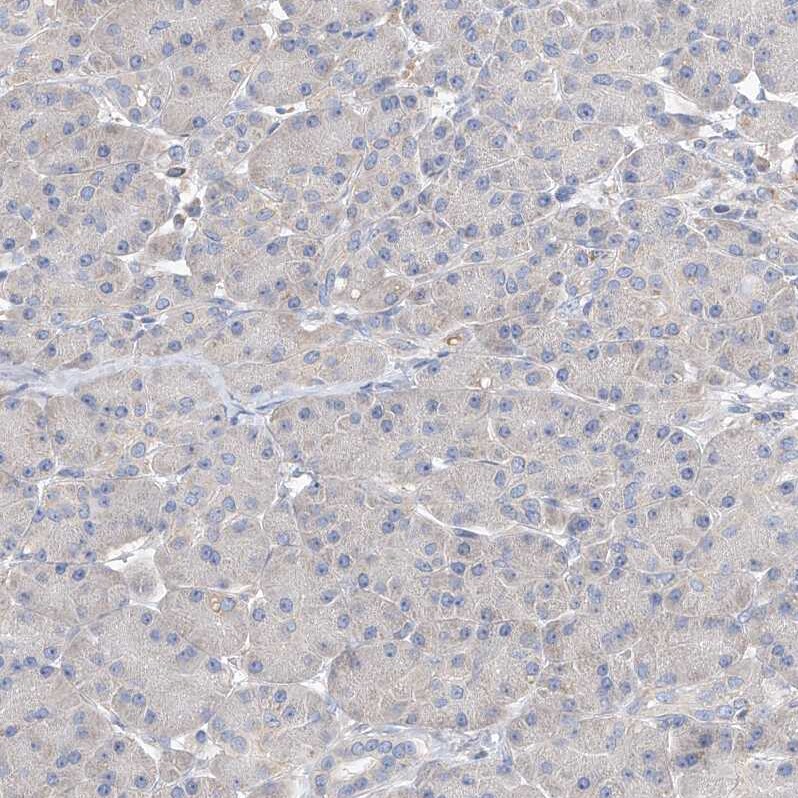 AMD1 Antibody - BSA Free Immunohistochemistry: AMD1 Antibody - BSA Free [NBP1-87093]