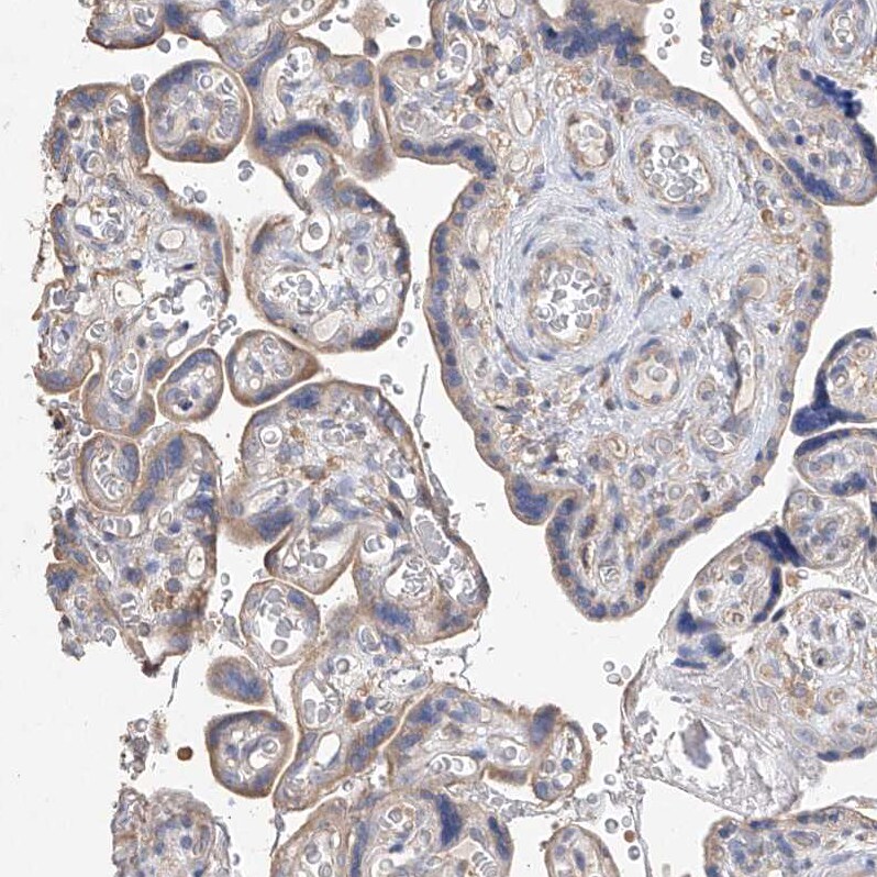 AMD1 Antibody - BSA Free Immunohistochemistry: AMD1 Antibody - BSA Free [NBP1-87093]