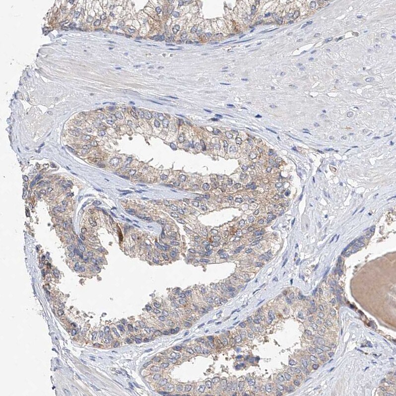 AMD1 Antibody - BSA Free Immunohistochemistry: AMD1 Antibody - BSA Free [NBP1-87093]