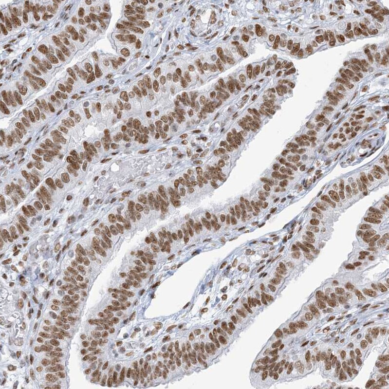 SA1 Antibody Immunohistochemistry-Paraffin: SA1 Antibody [NBP1-87097] -