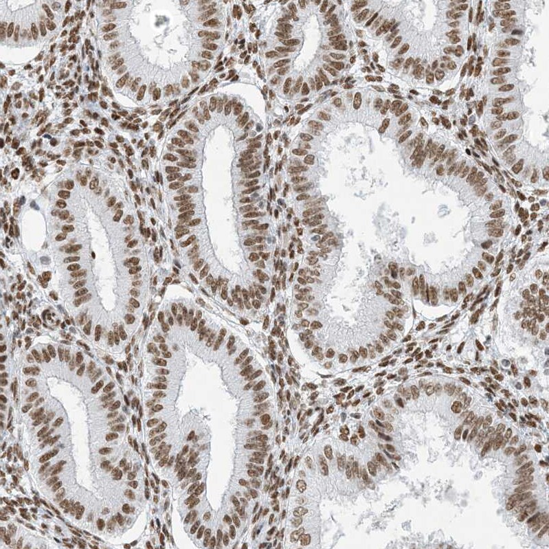 SA1 Antibody Immunohistochemistry-Paraffin: SA1 Antibody [NBP1-87097] -
