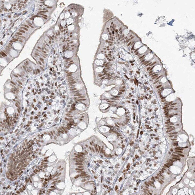 SA1 Antibody Immunohistochemistry-Paraffin: SA1 Antibody [NBP1-87097] -