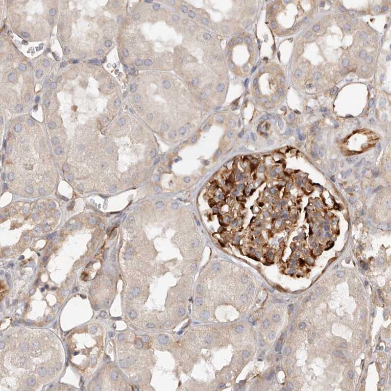 Ribosomal Protein S6/RPS6 Antibody - BSA Free Immunohistochemistry-Paraffin: Ribosomal Protein S6/RPS6 Antibody [NBP1-87099]