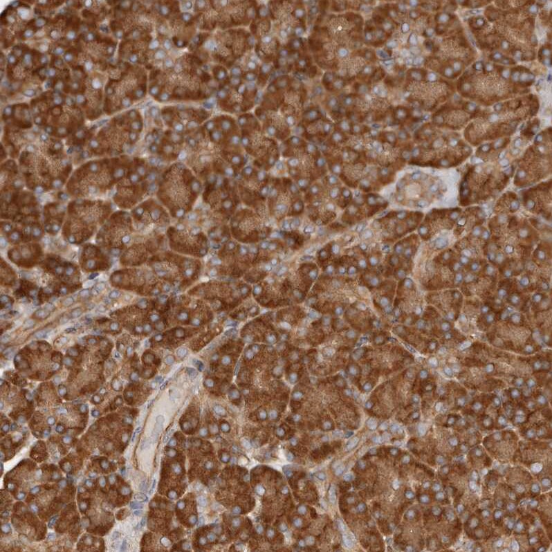 Ribosomal Protein S6/RPS6 Antibody - BSA Free Immunohistochemistry-Paraffin: Ribosomal Protein S6/RPS6 Antibody [NBP1-87099]