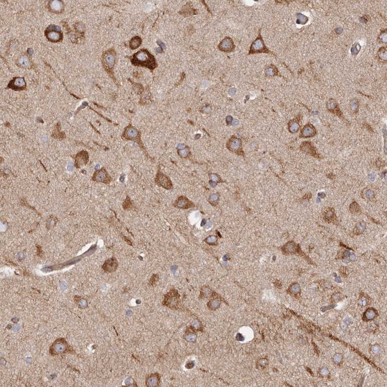 Ribosomal Protein S6/RPS6 Antibody - BSA Free Immunohistochemistry-Paraffin: Ribosomal Protein S6/RPS6 Antibody [NBP1-87099]