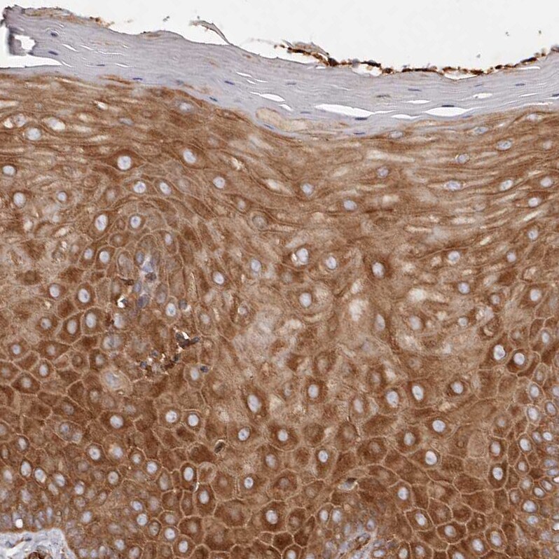 Ribosomal Protein S6/RPS6 Antibody - BSA Free Immunohistochemistry-Paraffin: Ribosomal Protein S6/RPS6 Antibody [NBP1-87099]