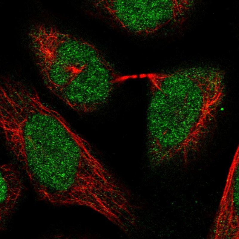 RPC62 Antibody - BSA Free Immunocytochemistry/ Immunofluorescence: RPC62 Antibody [NBP1-87110]