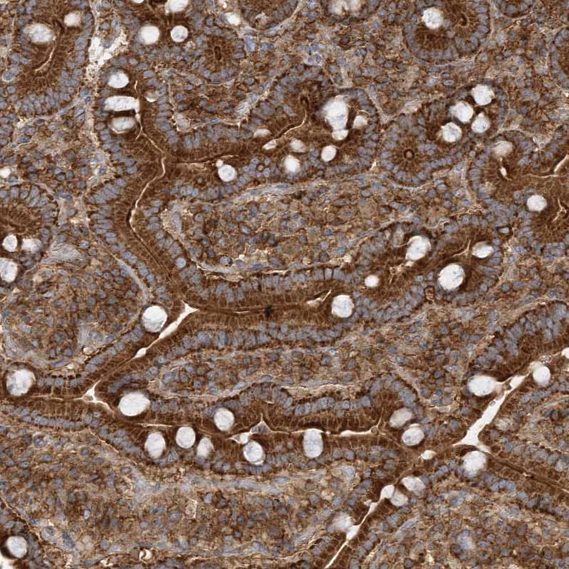 TRAIP Antibody - BSA Free Immunohistochemistry: TRAIP Antibody - BSA Free [NBP1-87125]