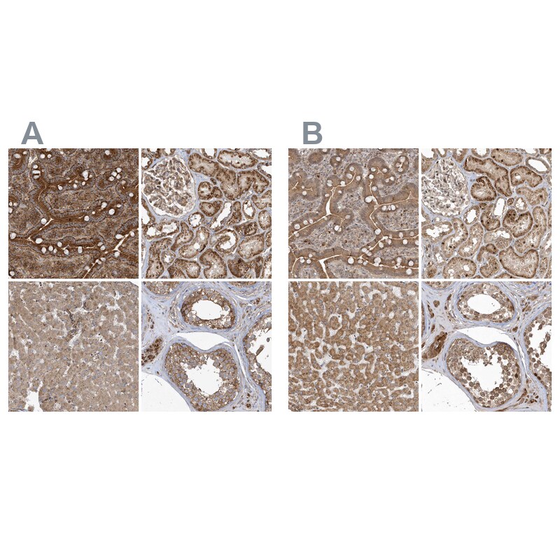 TRAIP Antibody - BSA Free Immunohistochemistry: TRAIP Antibody - BSA Free [NBP1-87125]