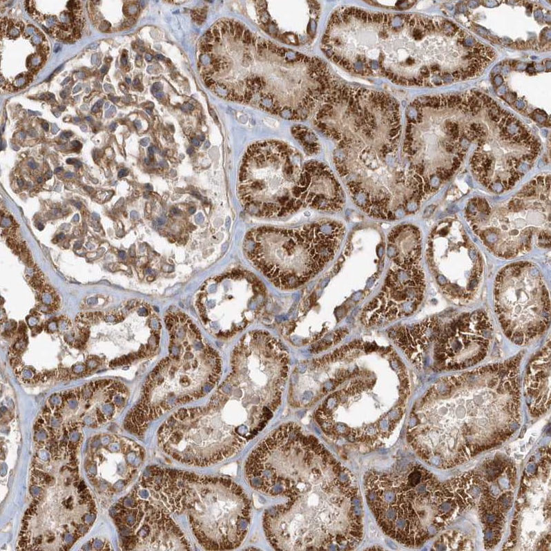 TRAIP Antibody - BSA Free Immunohistochemistry: TRAIP Antibody - BSA Free [NBP1-87125]