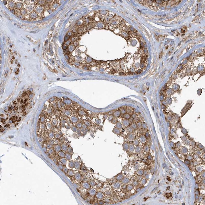 TRAIP Antibody - BSA Free Immunohistochemistry: TRAIP Antibody - BSA Free [NBP1-87125]