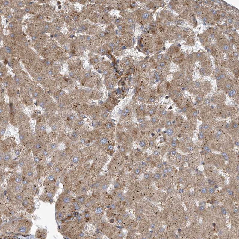 TRAIP Antibody - BSA Free Immunohistochemistry: TRAIP Antibody - BSA Free [NBP1-87125]