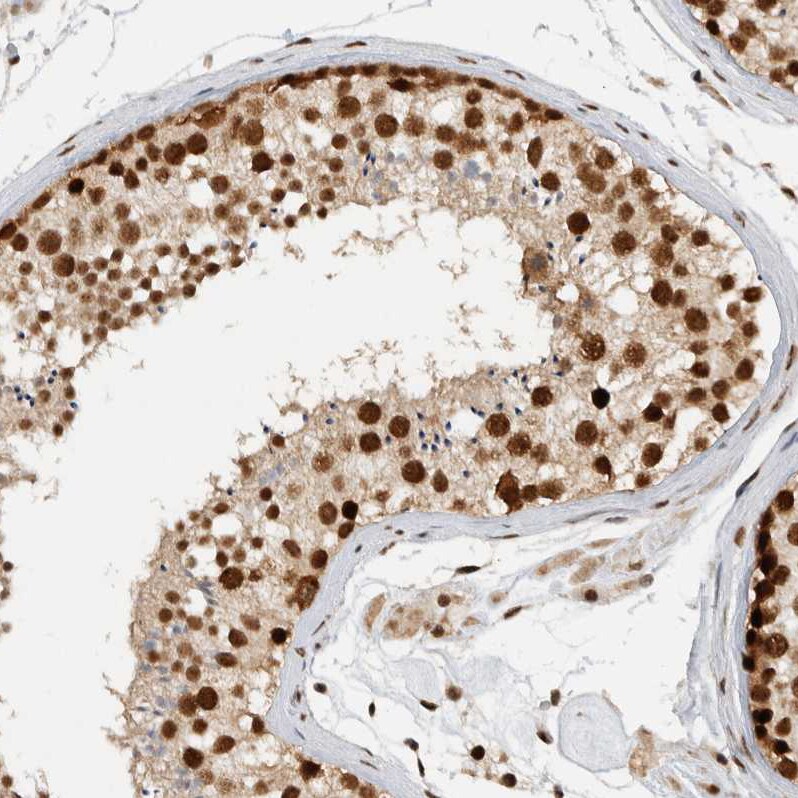 DDX42 Antibody - BSA Free Immunohistochemistry-Paraffin: DDX42 Antibody [NBP1-87133]