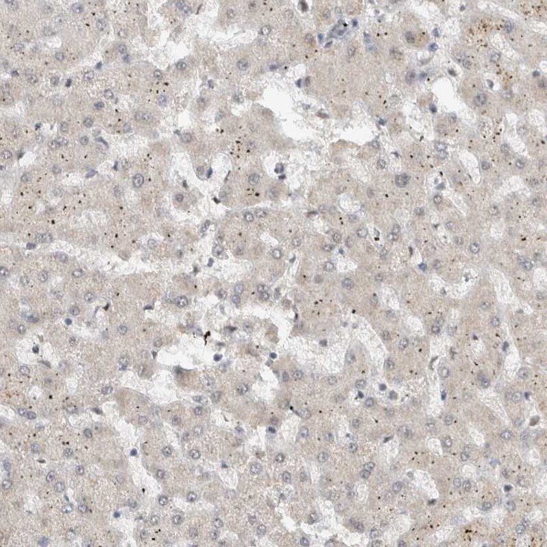 DDX42 Antibody - BSA Free Immunohistochemistry-Paraffin: DDX42 Antibody [NBP1-87133]