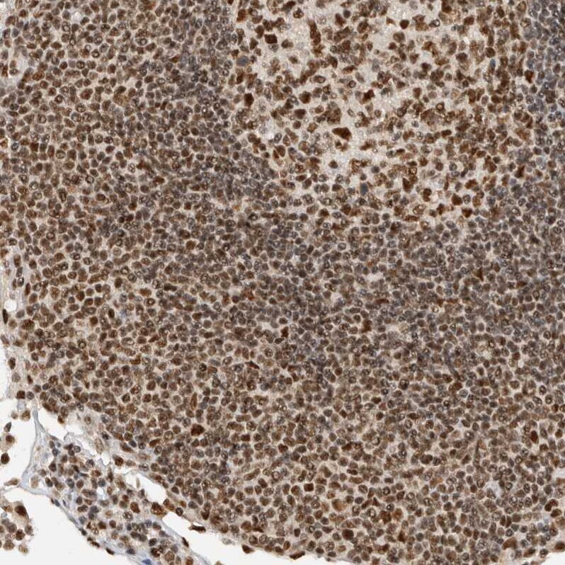 DDX42 Antibody - BSA Free Immunohistochemistry-Paraffin: DDX42 Antibody [NBP1-87133]