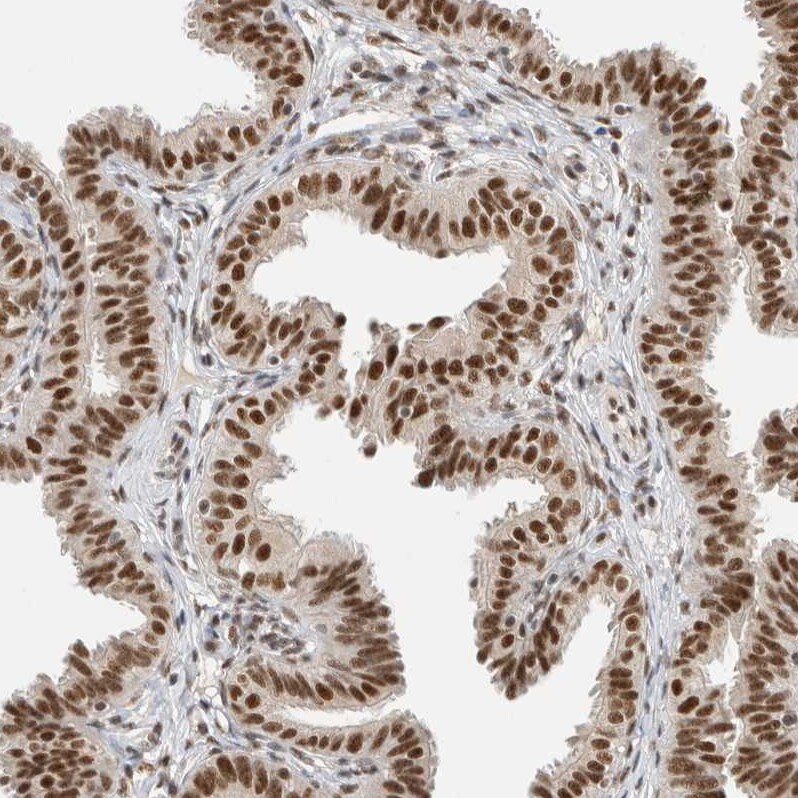 DDX42 Antibody - BSA Free Immunohistochemistry-Paraffin: DDX42 Antibody [NBP1-87133]