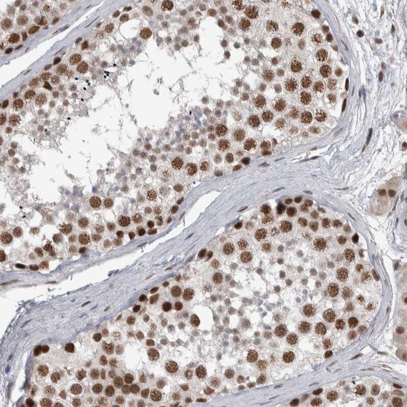 DDX42 Antibody - BSA Free Immunohistochemistry-Paraffin: DDX42 Antibody [NBP1-87134]