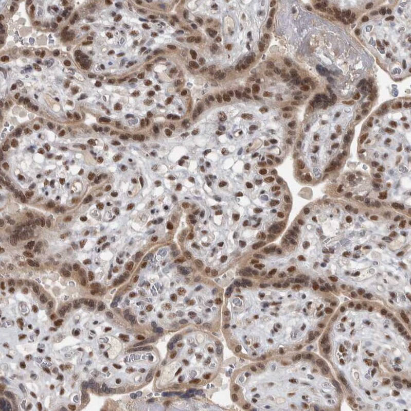 DDX42 Antibody - BSA Free Immunohistochemistry-Paraffin: DDX42 Antibody [NBP1-87134]