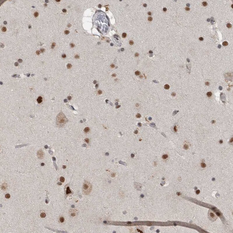 DDX42 Antibody - BSA Free Immunohistochemistry-Paraffin: DDX42 Antibody [NBP1-87134]