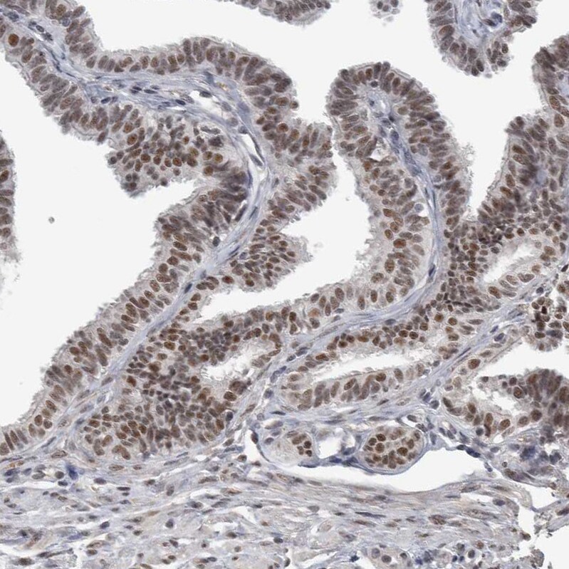 DDX42 Antibody - BSA Free Immunohistochemistry-Paraffin: DDX42 Antibody [NBP1-87134]