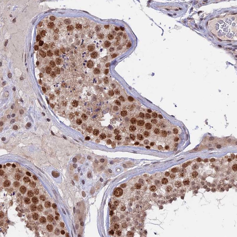 RFC5 Antibody - BSA Free Immunohistochemistry-Paraffin: RFC5 Antibody [NBP1-87137]