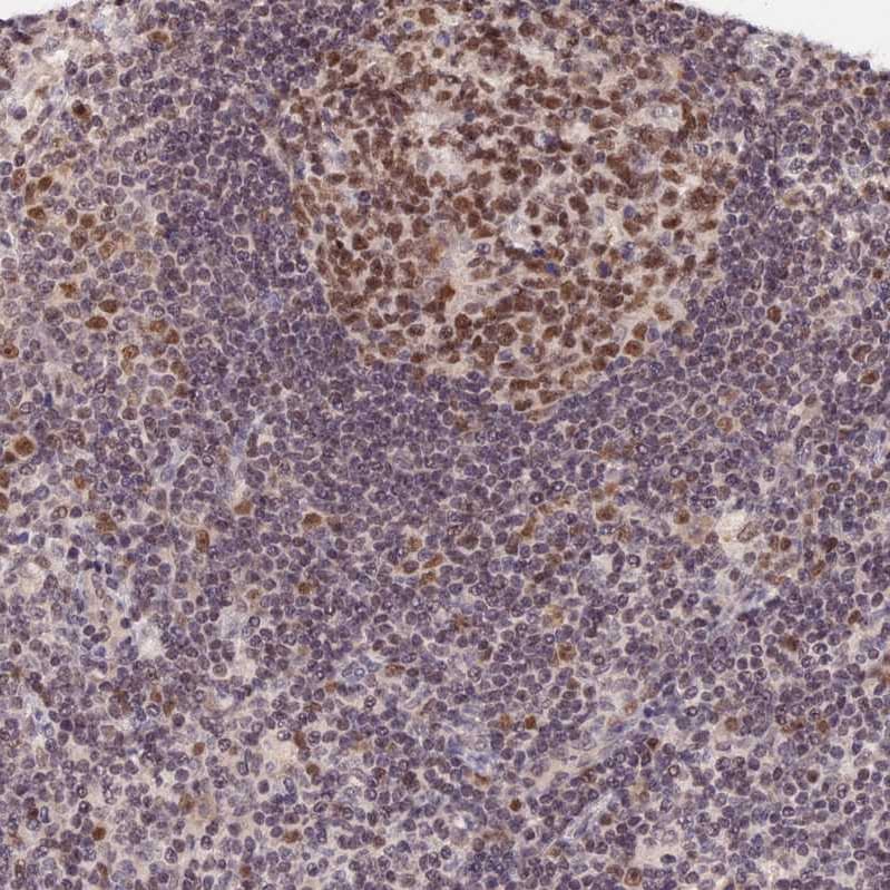 RFC5 Antibody - BSA Free Immunohistochemistry-Paraffin: RFC5 Antibody [NBP1-87137]