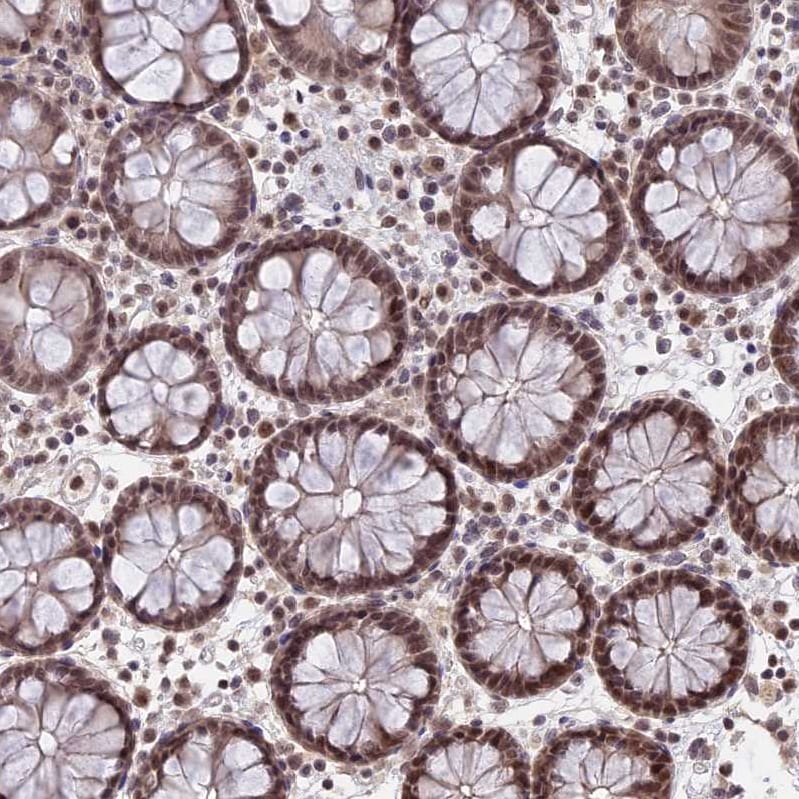 RFC5 Antibody - BSA Free Immunohistochemistry-Paraffin: RFC5 Antibody [NBP1-87137]