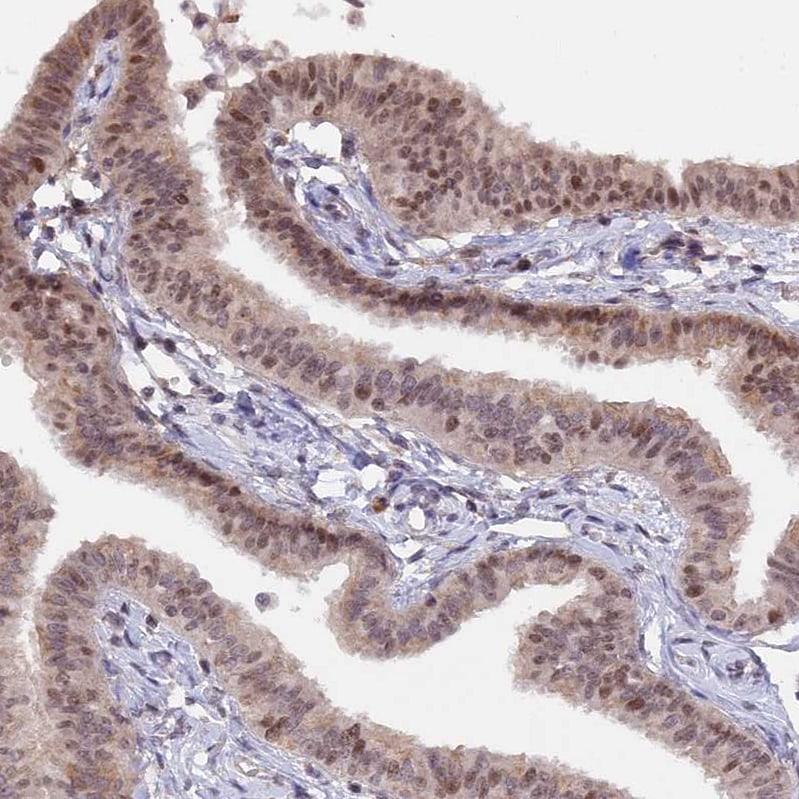 RFC5 Antibody - BSA Free Immunohistochemistry-Paraffin: RFC5 Antibody [NBP1-87137]