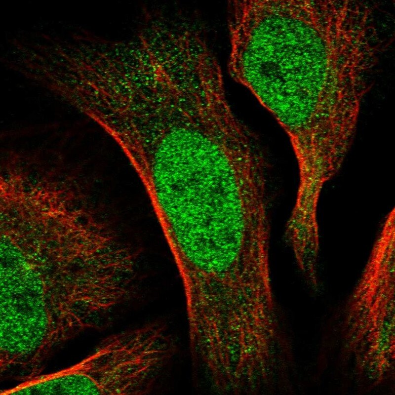 CDCA2 Antibody - BSA Free Immunocytochemistry/ Immunofluorescence: CDCA2 Antibody [NBP1-87140]