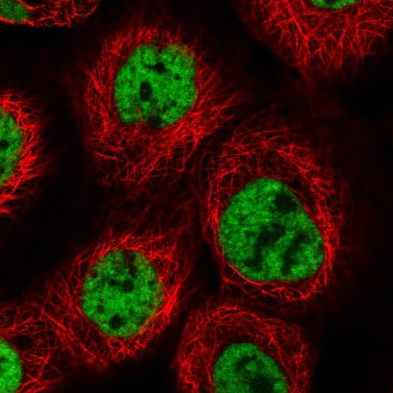 PRCC Antibody - BSA Free Immunocytochemistry/ Immunofluorescence: PRCC Antibody [NBP1-87152]