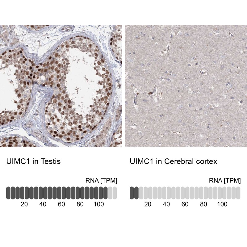 RAP80 Antibody - BSA Free Immunohistochemistry-Paraffin: RAP80 Antibody [NBP1-87157]