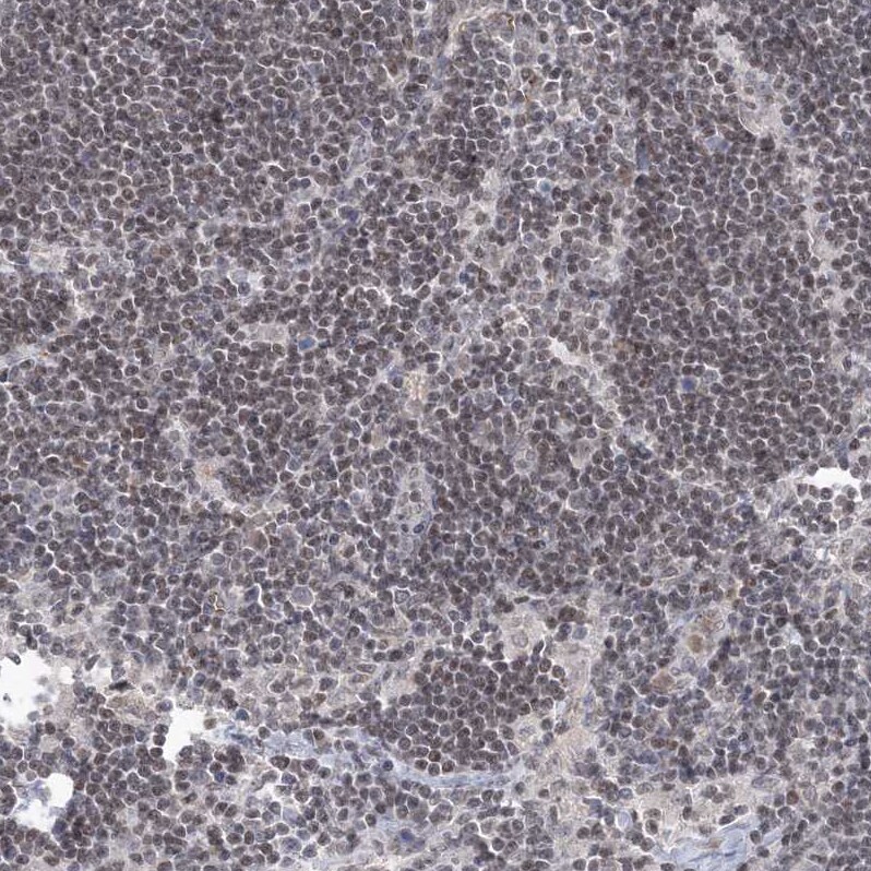RAP80 Antibody - BSA Free Immunohistochemistry-Paraffin: RAP80 Antibody [NBP1-87157]