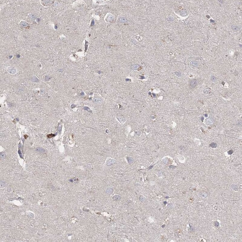 RAP80 Antibody - BSA Free Immunohistochemistry-Paraffin: RAP80 Antibody [NBP1-87157]